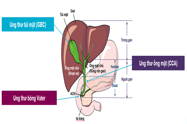 Những điều cần biết về Ung thư đường mật