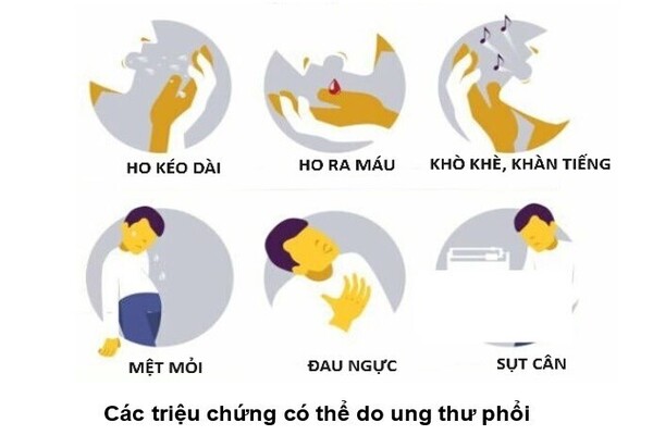 TRIỆU CHỨNG UNG THƯ PHỔI